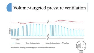 Volume-targeted pressure ventilation
 