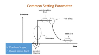 Common Setting Parameter
➢ Flow-based’ trigger,
➢ (Recent, shorter delay)
 