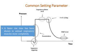 Common Setting Parameter
➢ A faster rise time has been
shown to unload respiratory
muscles more completely.
 