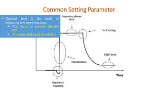 Common Setting Parameter
➢ Optimal level is the result of
balancing two opposing aims:
➢ The desire to provide effective
MV
➢ Minimize leaks and discomfort
 