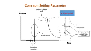 Common Setting Parameter
➢ Time-cycled
 