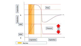 Flow
Pressure
InspirationExpiration
IPAP
EPAP
0
0
PS
Inspiration Expiration
Rise time
 