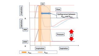Flow
Pressure
InspirationExpiration
IPAP
EPAP
0
0
PS
Inspiration Expiration
PIF
TiMIN TiMAX
Cycling occurs between
TIMIN and TIMAX
 