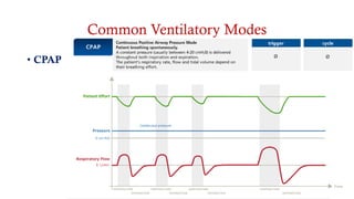 Common Ventilatory Modes
• CPAP
• S (Sponteous)
• S/T (Sponteous-Timed )
• PAC (Pressure Assist Control)
• T (Timed)
 