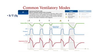 Common Ventilatory Modes
• S/T (Sponteous-Timed )
• PAC (Pressure Assist Control)
• T (Timed)
 