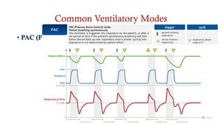 Common Ventilatory Modes
• PAC (Pressure Assist Control)
 