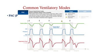 Common Ventilatory Modes
• PAC (Pressure Assist Control)
 