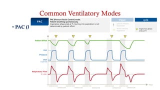 Common Ventilatory Modes
• PAC (Pressure Assist Control)
 