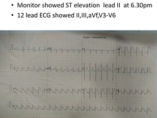 • Monitor showed ST elevation lead II at 6.30pm
• 12 lead ECG showed II,III,aVf,V3-V6
 