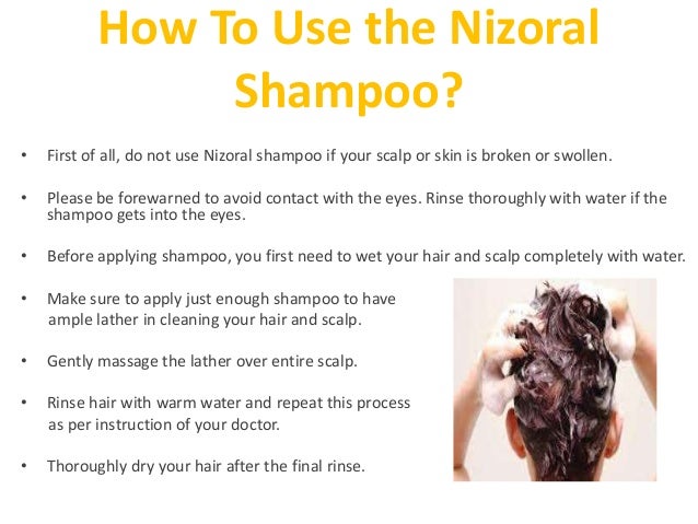 How to use nizoral shampoo for tinea versicolor