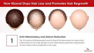 Nizoral Shampoo Review