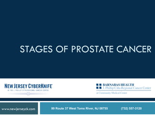 STAGES OF PROSTATE CANCER
99 Route 37 West Toms River, NJ 08755 (732) 557-3120www.newjerseyck.com
 