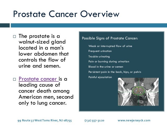 Stages of Prostate Cancer