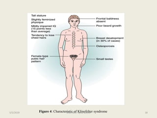 Figure 4: Characteristic of Klinefelter syndromeMDE 605. Njilla steeve 185/5/2019
 