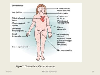 Figure 7: Characteristic of turner syndrome
MDE 605. Njilla steeve 235/5/2019
 