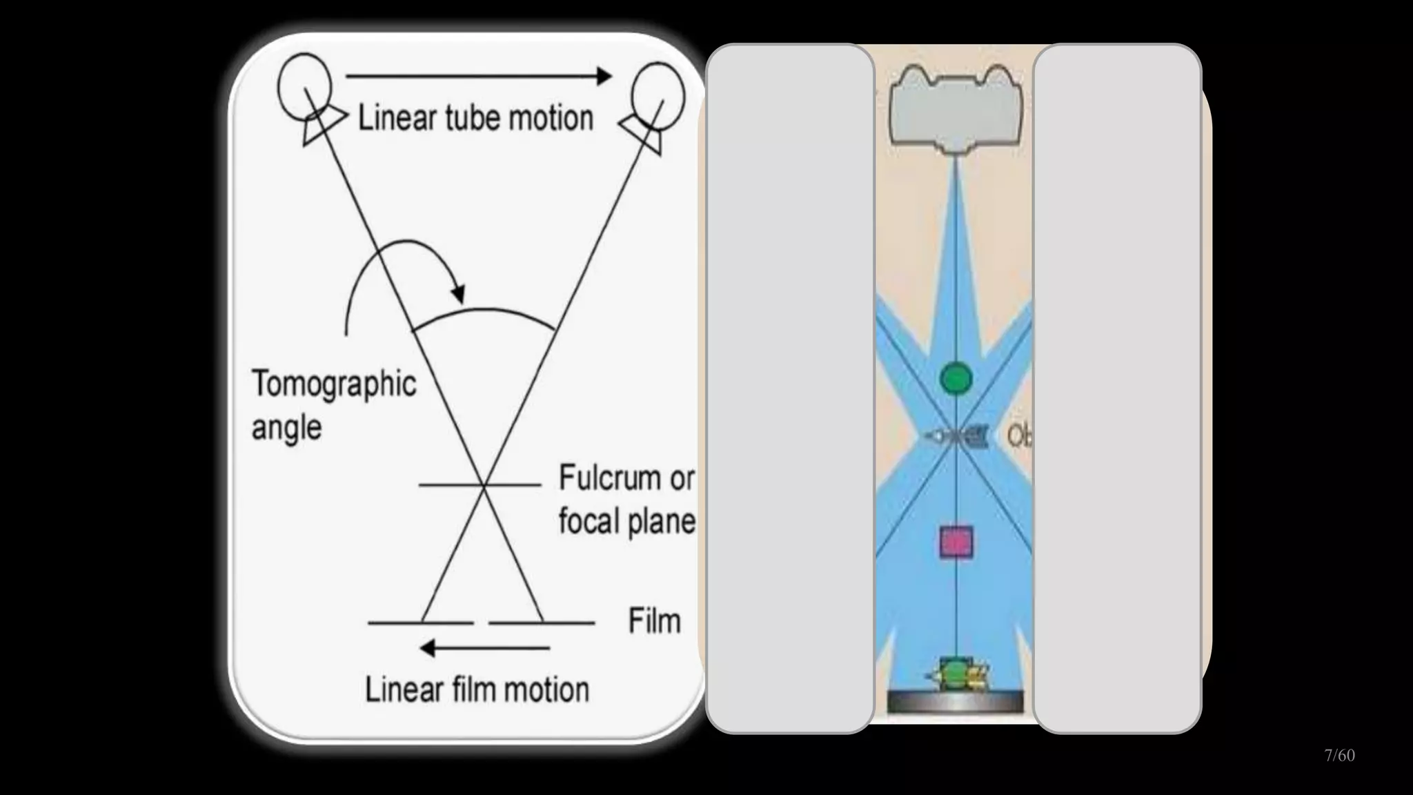 Panaromic radiography | PPTX