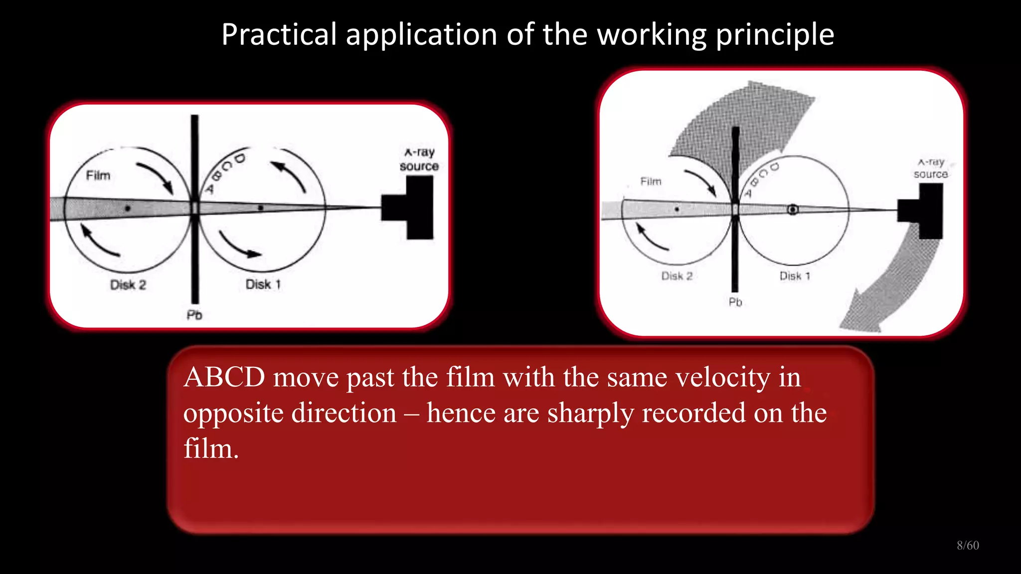 Panaromic radiography | PPTX