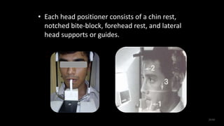 • Each head positioner consists of a chin rest,
notched bite-block, forehead rest, and lateral
head supports or guides.
20/60
 