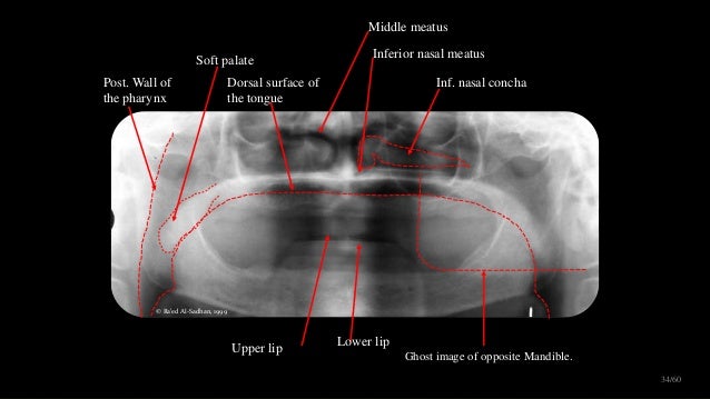 Panaromic radiography