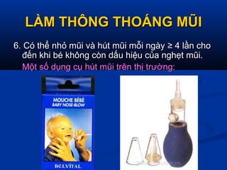 LÀM THÔNG THOÁNG MŨILÀM THÔNG THOÁNG MŨI
6. Có thể nhỏ mũi và hút mũi mỗi ngày6. Có thể nhỏ mũi và hút mũi mỗi ngày ≥ 4≥ 4 lần cholần cho
đến khi bé không còn dấu hiệu của nghẹt mũi.đến khi bé không còn dấu hiệu của nghẹt mũi.
Một số dụng cụ hút mũi trên thị trường:Một số dụng cụ hút mũi trên thị trường:
 