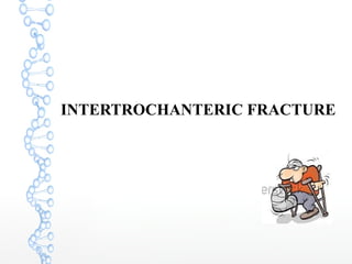 INTERTROCHANTERIC FRACTURE
 