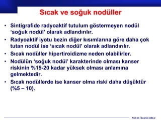 Prof.Dr. İbrahim USLU
Sıcak ve soğuk nodüller
• Sintigrafide radyoaktif tutulum göstermeyen nodül
‘soğuk nodül’ olarak adlandırılır.
• Radyoaktif iyotu bezin diğer kısımlarına göre daha çok
tutan nodül ise ‘sıcak nodül’ olarak adlandırılır.
• Sıcak nodüller hipertiroidizme neden olabilirler.
• Nodülün ‘soğuk nodül’ karakterinde olması kanser
riskinin %15-20 kadar yüksek olması anlamına
gelmektedir.
• Sıcak nodüllerde ise kanser olma riski daha düşüktür
(%5 – 10).
 