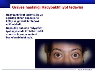 Prof.Dr. İbrahim USLU
Graves hastalığı Radyoaktif iyot tedavisi
• Radyoaktif iyot tedavisi ile ve
ağızdan alınan kapsüllerle
kolay ve güvenli bir tedavi
edilmektedir.
• Kapsülde bulunan radyoaktif
iyot sayesinde tiroid bezindeki
anormal hormon sentezi
baskılanabilmektedir.
 