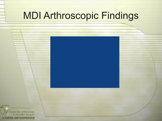 MDI Arthroscopic Findings
 
