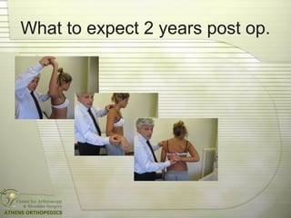 What to expect 2 years post op.
 