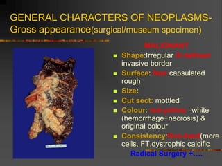 GENERAL CHARACTERS OF NEOPLASMS-
Gross appearance(surgical/museum specimen)
MALIGNANT
 Shape:Irregular ill defined
invasive border
 Surface: Non capsulated
rough
 Size:
 Cut sect: mottled
 Colour: red-yellow –white
(hemorrhage+necrosis) &
original colour
 Consistency:firm-hard(more
cells, FT,dystrophic calcific
Radical Surgery +….
 