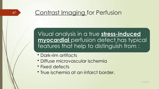 Fixed Defect NL Basic Cardiovascular MRI magnetic.pptx