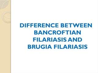 DIFFERENCE BETWEEN
BANCROFTIAN
FILARIASIS AND
BRUGIA FILARIASIS
 