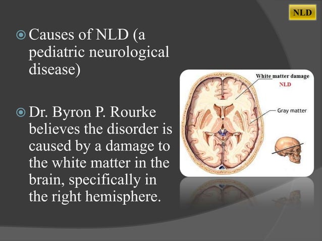 Nonverbal Learning Disability