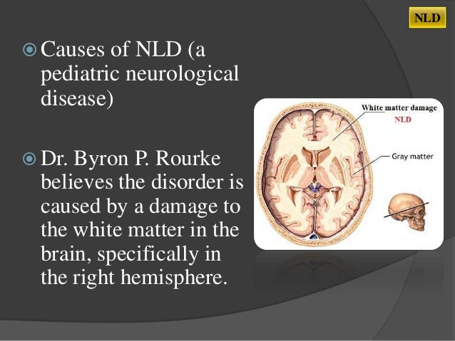 What Is Non Verbal Learning Disorder >> Nonverbal Learning Disability What Is Non Verbal Learning Disorder >> Nonverbal Learning Disability