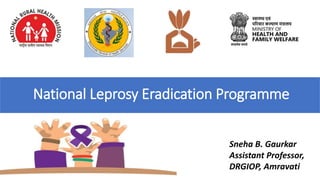 National Leprosy Eradication Programme
Sneha B. Gaurkar
Assistant Professor,
DRGIOP, Amravati
 