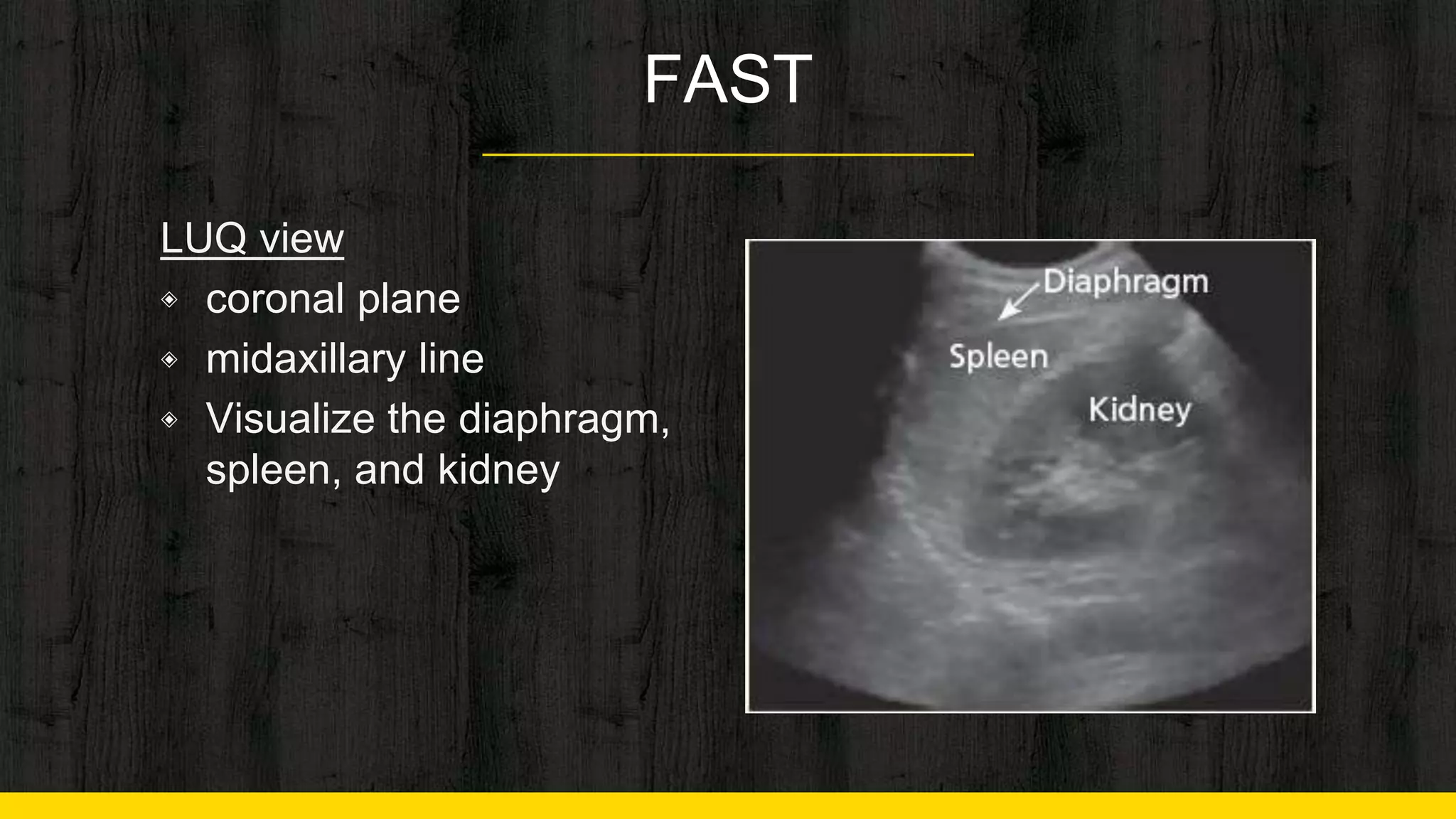 Initial Assessment and Management for Trauma | PPTX