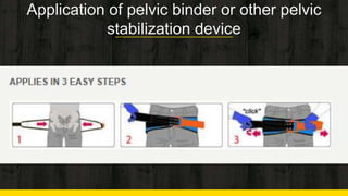 Pelvis Binders Sam Splints Guide.pdf Initial Assessment and Management for Trauma | PPTX