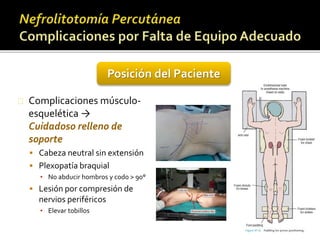 Complicaciones músculo-esquelética 
→ 
Cuidadoso relleno de 
soporte 
 Cabeza neutral sin extensión 
 Plexopatía braquial 
▪ No abducir hombros y codo > 90° 
 Lesión por compresión de 
nervios periféricos 
▪ Elevar tobillos 
Posición del Paciente 
 