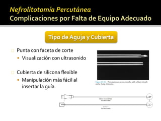 Tipo de Aguja y Cubierta 
Punta con faceta de corte 
 Visualización con ultrasonido 
Cubierta de silicona flexible 
 Manipulación más fácil al 
insertar la guía 
 