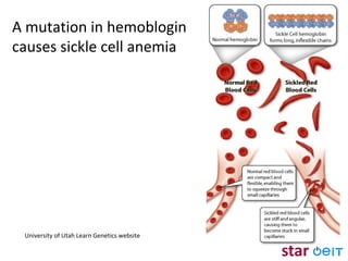 A mutation in hemoblogin causes sickle cell anemia University of Utah Learn Genetics website 