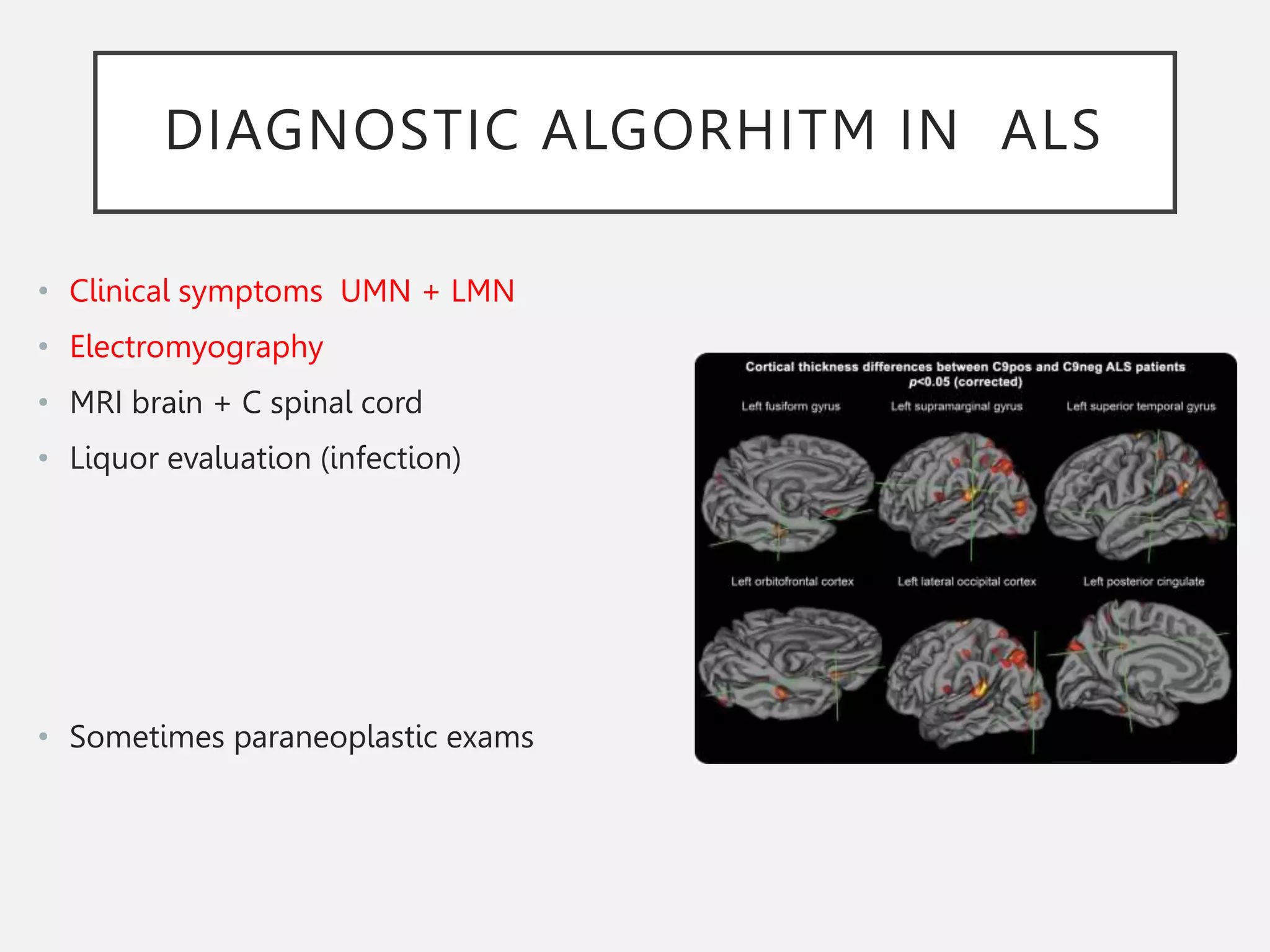 DIAGNOSTIC ALGORHITM IN ALS
• Clinical symptoms UMN + LMN
• Electromyography
• MRI brain + C spinal cord
• Liquor evaluation (infection)
• Sometimes paraneoplastic exams
 