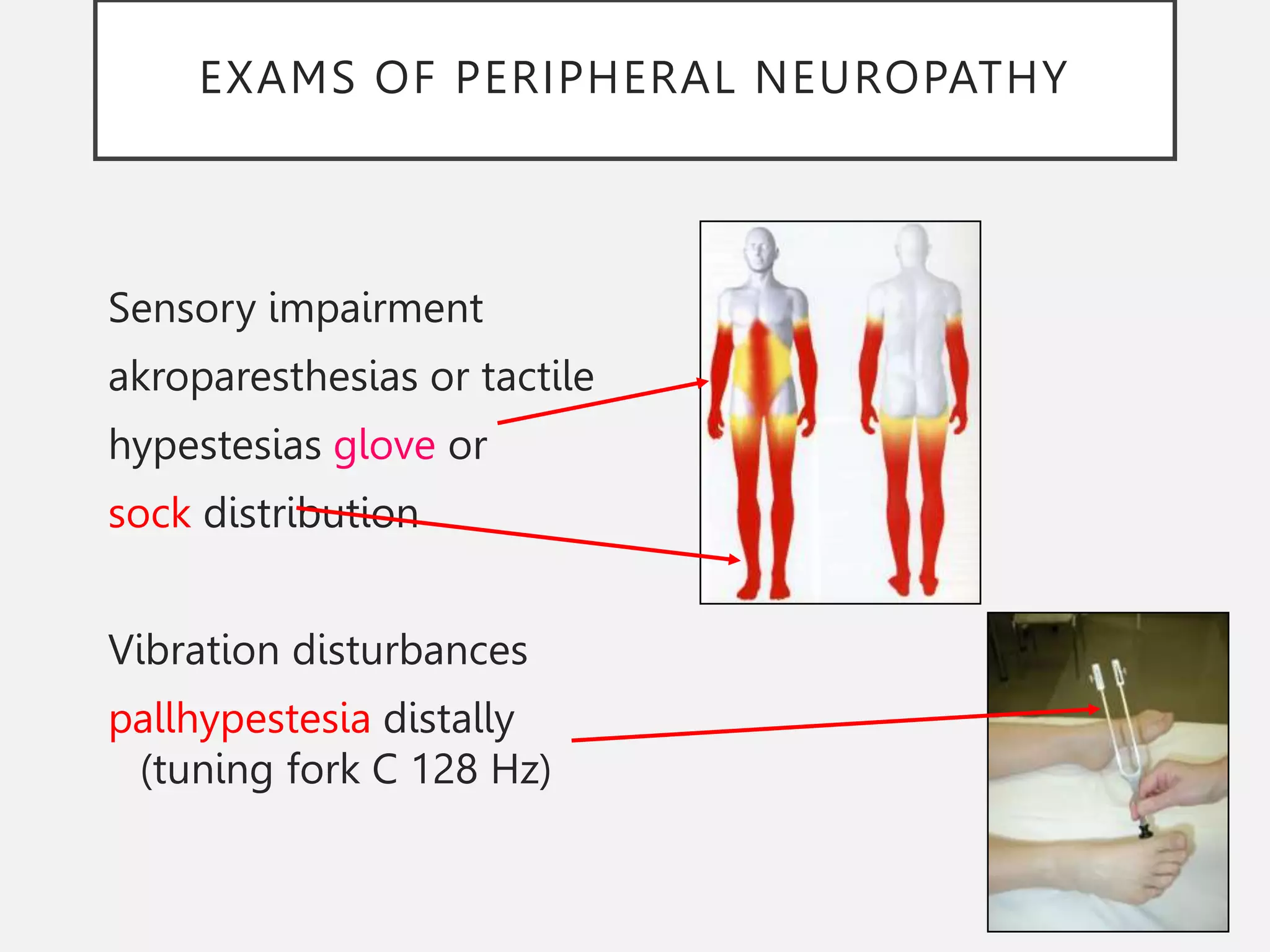 EXAMS OF PERIPHERAL NEUROPATHY
Sensory impairment
akroparesthesias or tactile
hypestesias glove or
sock distribution
Vibration disturbances
pallhypestesia distally
(tuning fork C 128 Hz)
 
