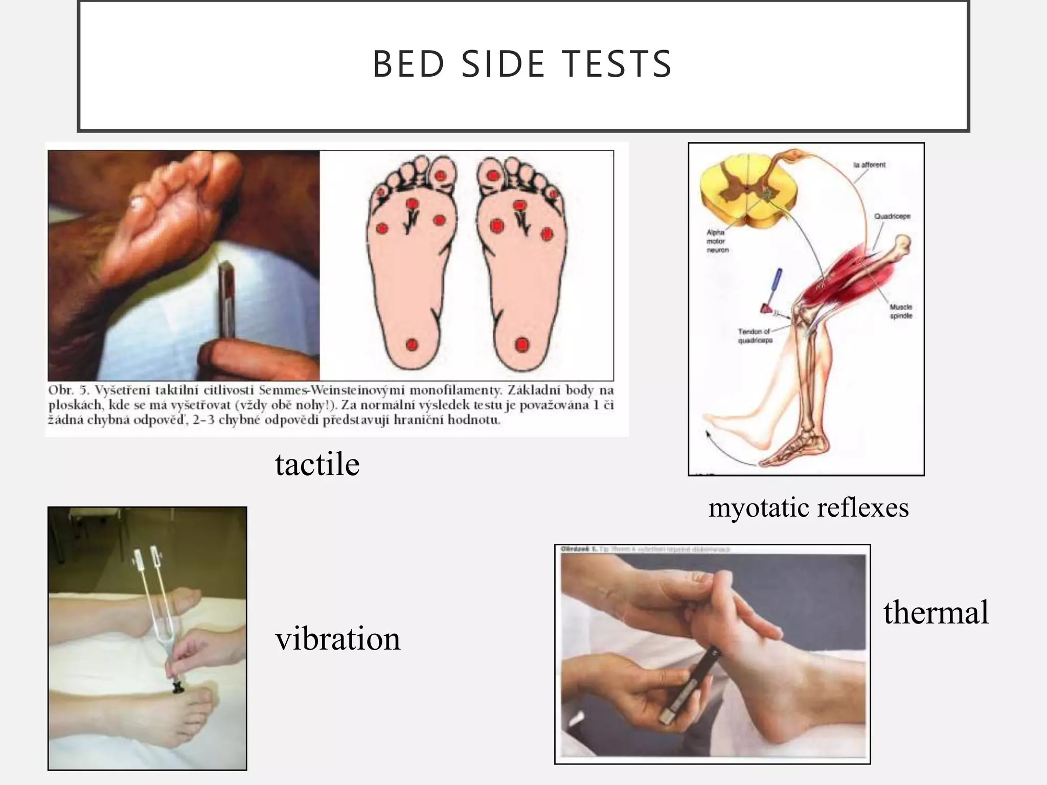 BED SIDE TESTS
tactile
vibration
thermal
myotatic reflexes
 