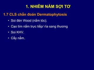 1.7 CLS chẩn đoán Dermatophytosis
• Soi đèn Wood (nấm tóc).
• Cạo tìm nấm trực tiếp/ rìa sang thương
• Soi KHV.
• Cấy nấm.
1. NHIỄM NẤM SỢI TƠ
 