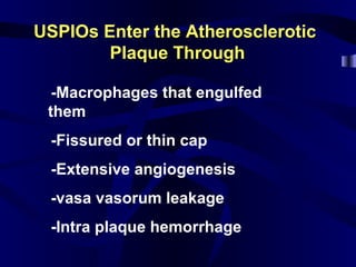 USPIOs Enter the AtheroscleroticUSPIOs Enter the Atherosclerotic
Plaque ThroughPlaque Through
l-Macrophages that engulfed
them
l-Fissured or thin cap
l-Extensive angiogenesis
l-vasa vasorum leakage
l-Intra plaque hemorrhage
 