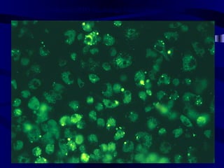 FL-labeled SPIO Incubated Macrophages 24hr
 