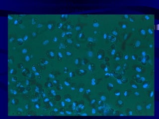 Double DAPI Staining with Fluorescence-labeled SPIO Macrophages
after 24hr Incubation
 