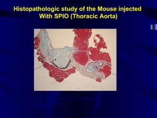 Histopathologic study of the Mouse injected
With SPIO (Thoracic Aorta)
ApoE KO mouse, Movat staining,
proximal aorta
Coronary
Cross section
Atherosclerosis
plaque
 