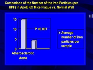 Comparison of the Number of the Iron Particles (per
HPF) in ApoE KO Mice Plaque vs. Normal Wall
0
5
10
15
Atherosclerotic
Aorta
Average
number of iron
particles per
sample
P <0.001
 