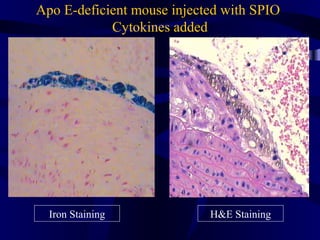 Iron Staining H&E Staining
Apo E-deficient mouse injected with SPIO
Cytokines added
 